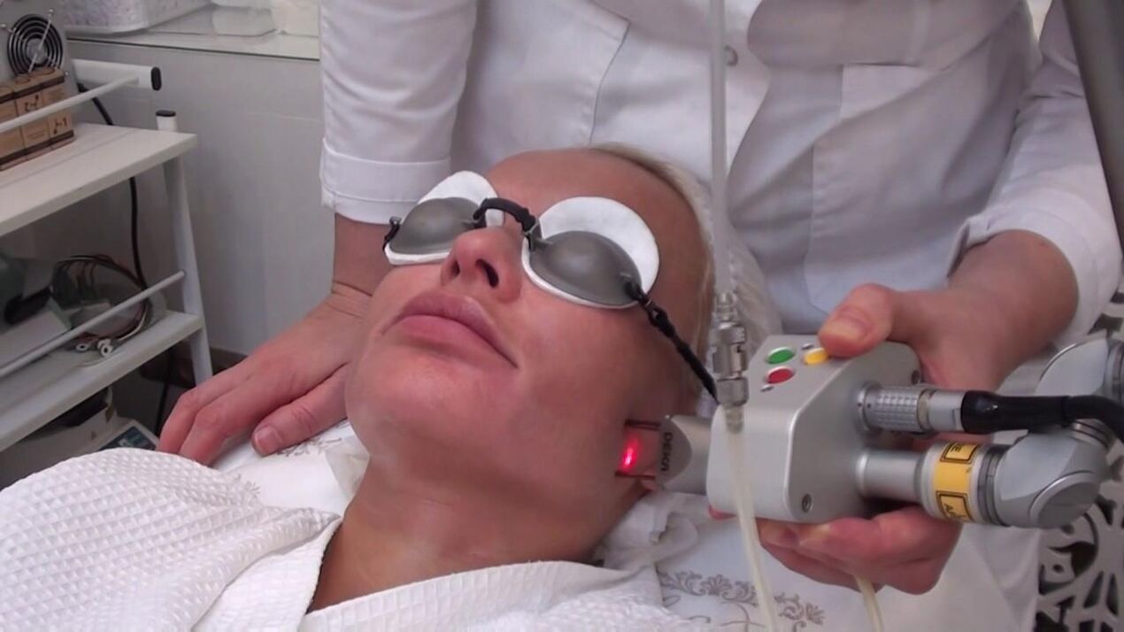 Laser beam treatment of problematic areas of the face skin
