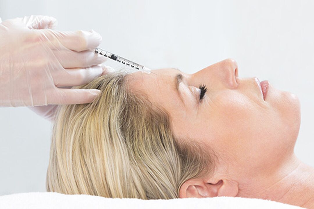 Plasmolifting is a facial skin rejuvenation injection method